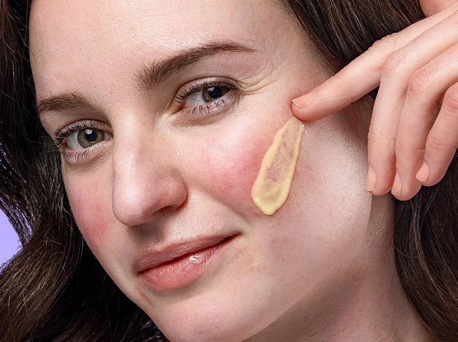 Acne-SR-Thumbnail_2.jpg