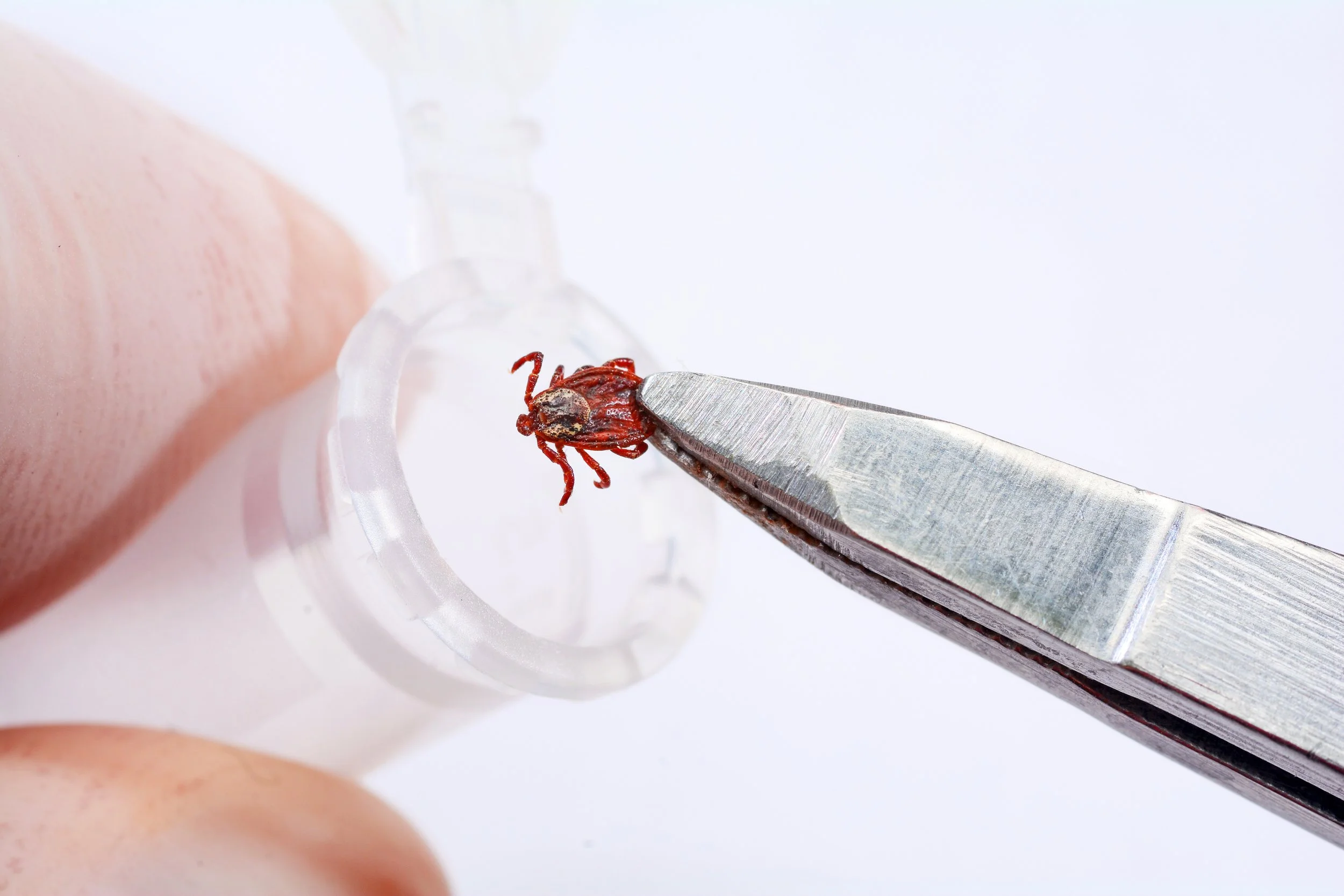 Removing a tick from the skin using tweezers