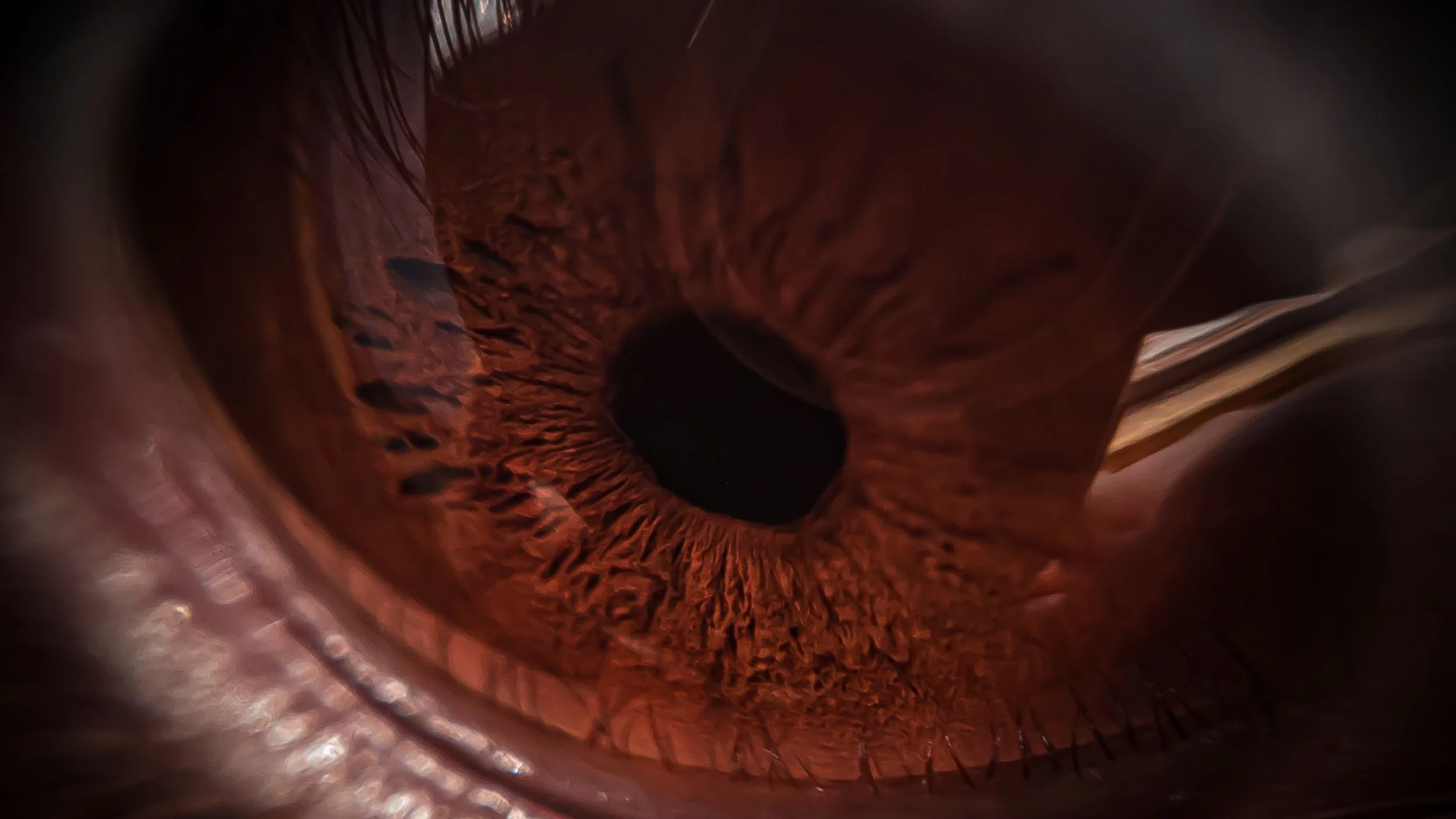 Close-up view of a human eye's iris with a dark pupil in the center, showing detailed textures and reddish-brown coloration.