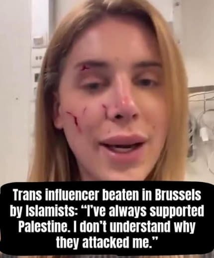 A woman with visible facial injuries and stitches, speaking in front of medical equipment. Text overlay about her being beaten and her support for Palestine.
