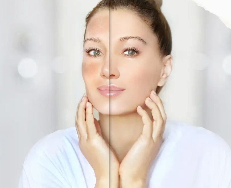 A woman split in half, showing a before and after of skincare or makeup application, with clear, glowing skin and a gentle expression.