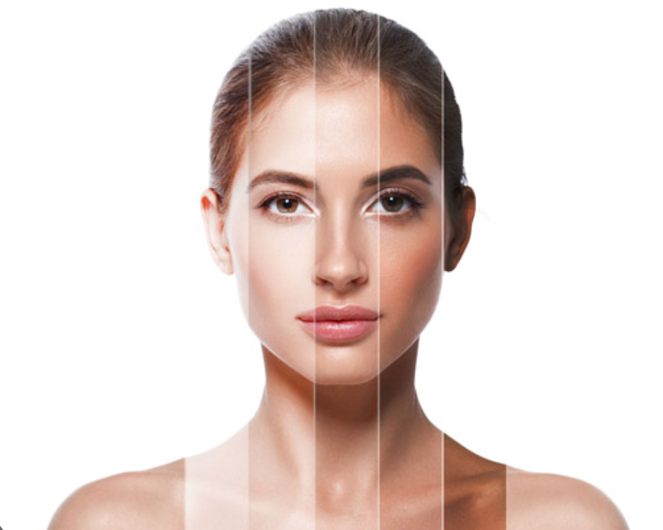 A woman’s face with visible differences in skin tone and texture across four vertical sections, illustrating a comparison or transition.