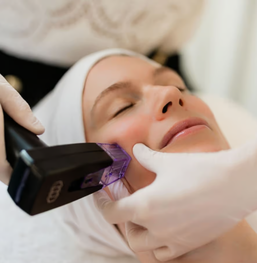 A woman receiving a cosmetic laser treatment on her face in a clinical setting, with her eyes closed and a serene expression.