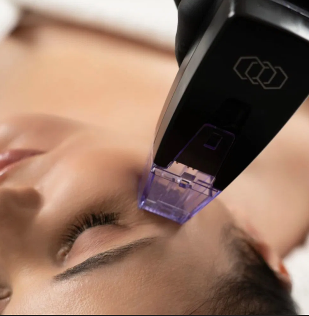 Person receiving a facial treatment using a laser device on their forehead.