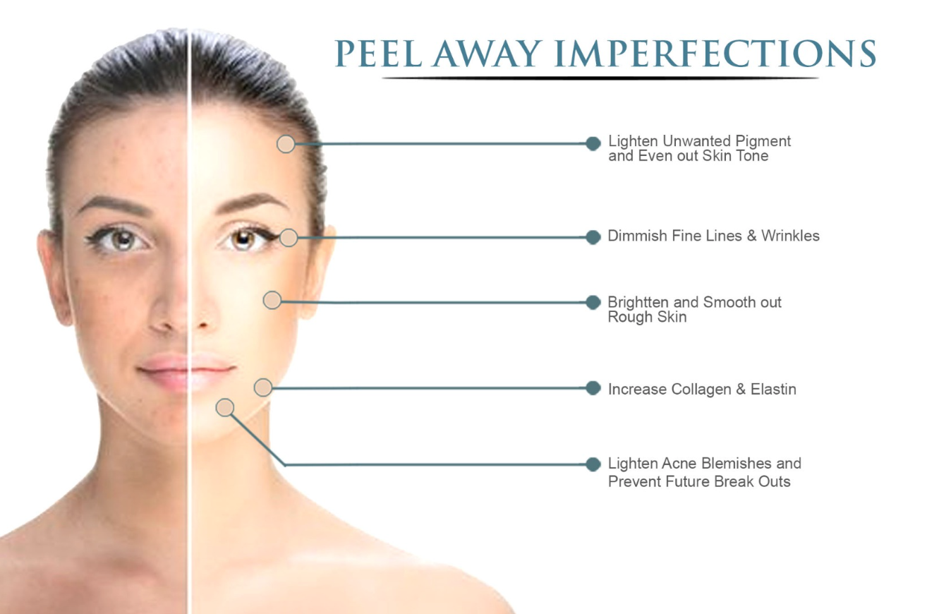 Side-by-side comparison of a woman's face showing skin improvements after using a product, with annotations highlighting benefits like lightening pigmentation, diminishing fine lines and wrinkles, brightening rough skin, increasing collagen and elastin, and lightening acne blemishes.