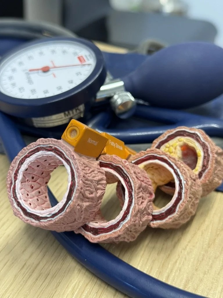 Anatomisches Modell verschiedener Arterienquerschnitte neben einem Blutdruckmessgerät – Symbol für Herz-Kreislauf-Check und Risikobewertung.