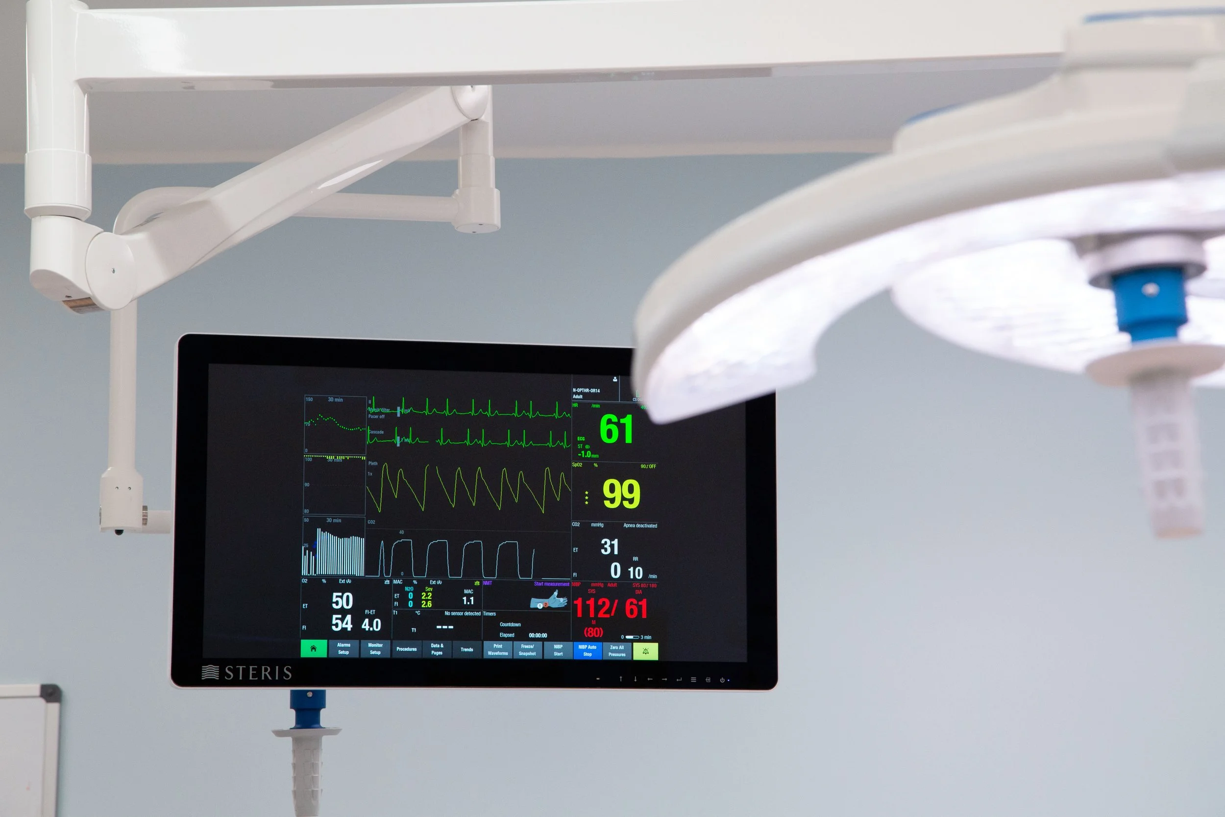 Medical monitor displaying vital signs including heart rate, oxygen saturation, and blood pressure, attached to an IV pole in a hospital setting.