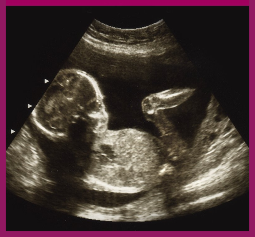 Wellbeing Baby Scan Cardiff