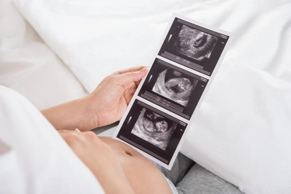 Person holding an ultrasound printout of three fetal images.