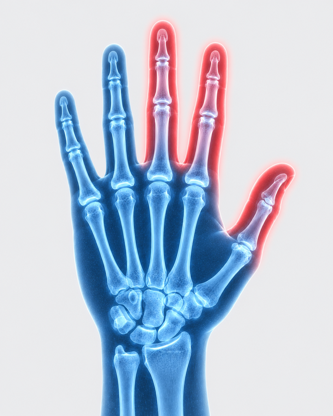 X-ray image of a human hand with the middle finger highlighted in red to indicate pain or injury.