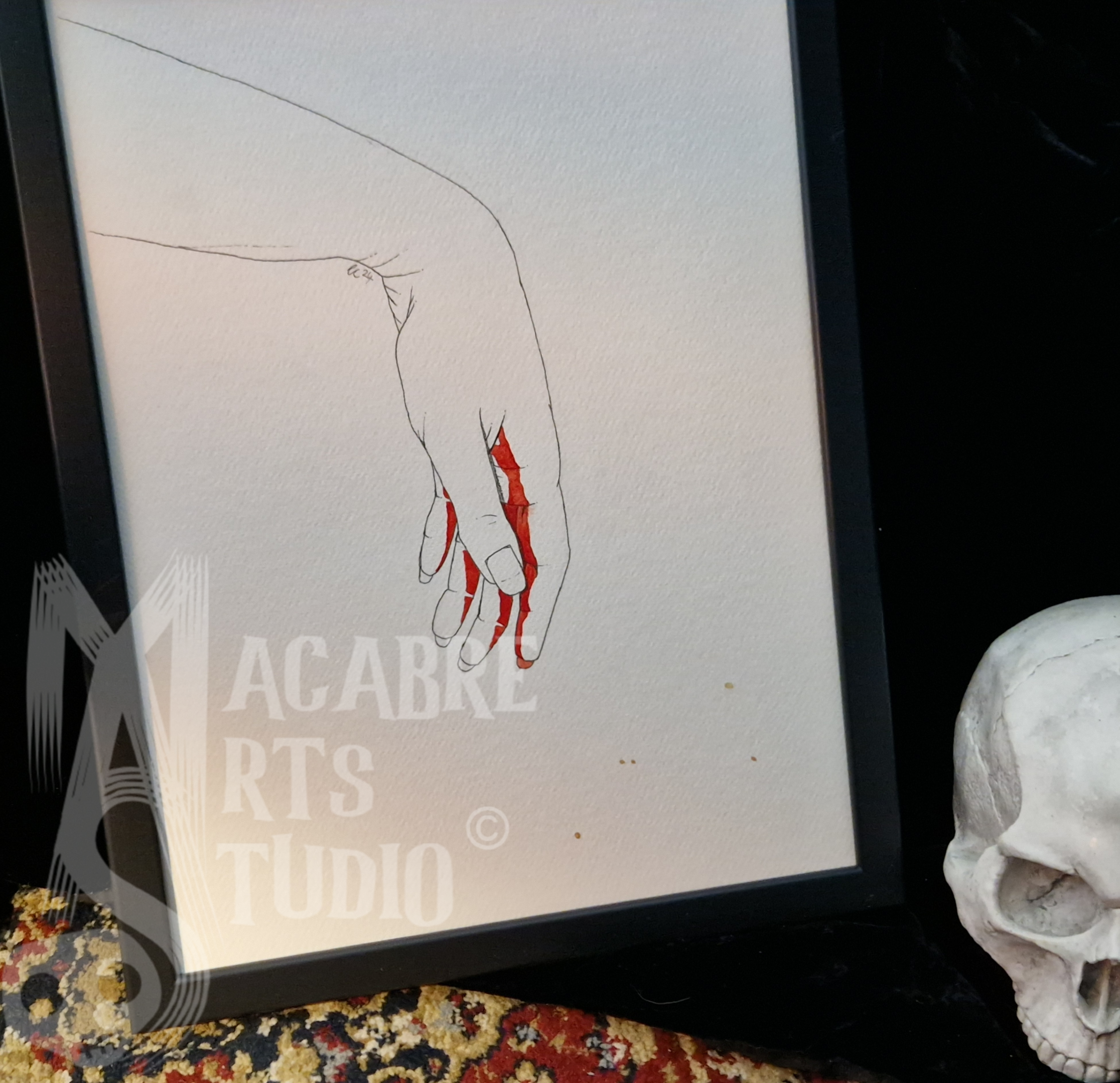 A n illustration of a limp hand with red staining the palm. Overlaid with copyright watermark.