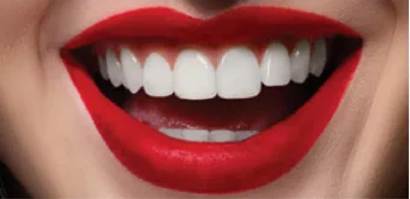 Close-up of a person smiling showing red lipstick and white teeth.