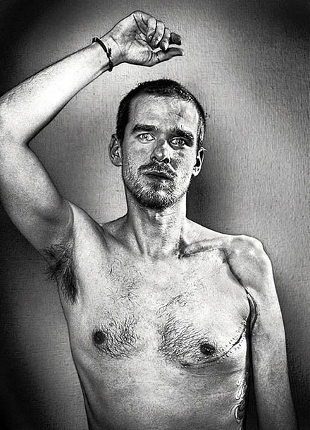 Black & white photo of a shirtless man raising their right arm with closed, looking directly at the camera. A photographer rediscovers their craft after an accident, realizing the experience hasn’t erased their vision, it has become their subject.PHE