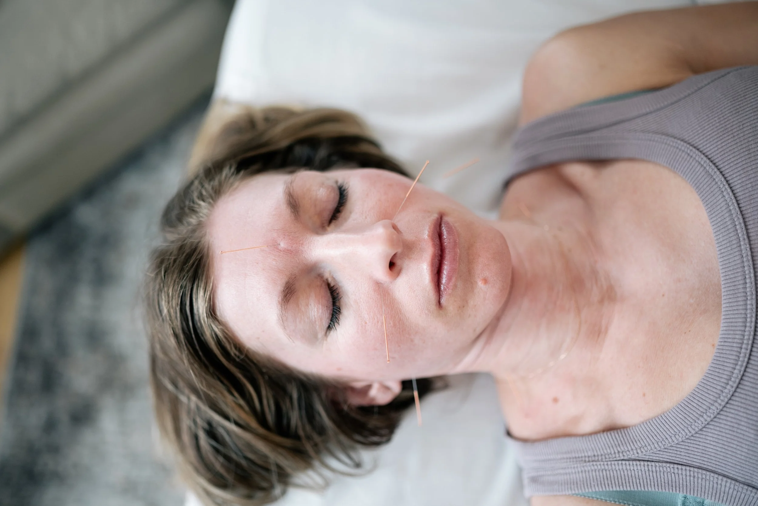 Acupuncture for Perimenopause: How Acupuncture May Support Symptoms &amp; Hormonal Changes