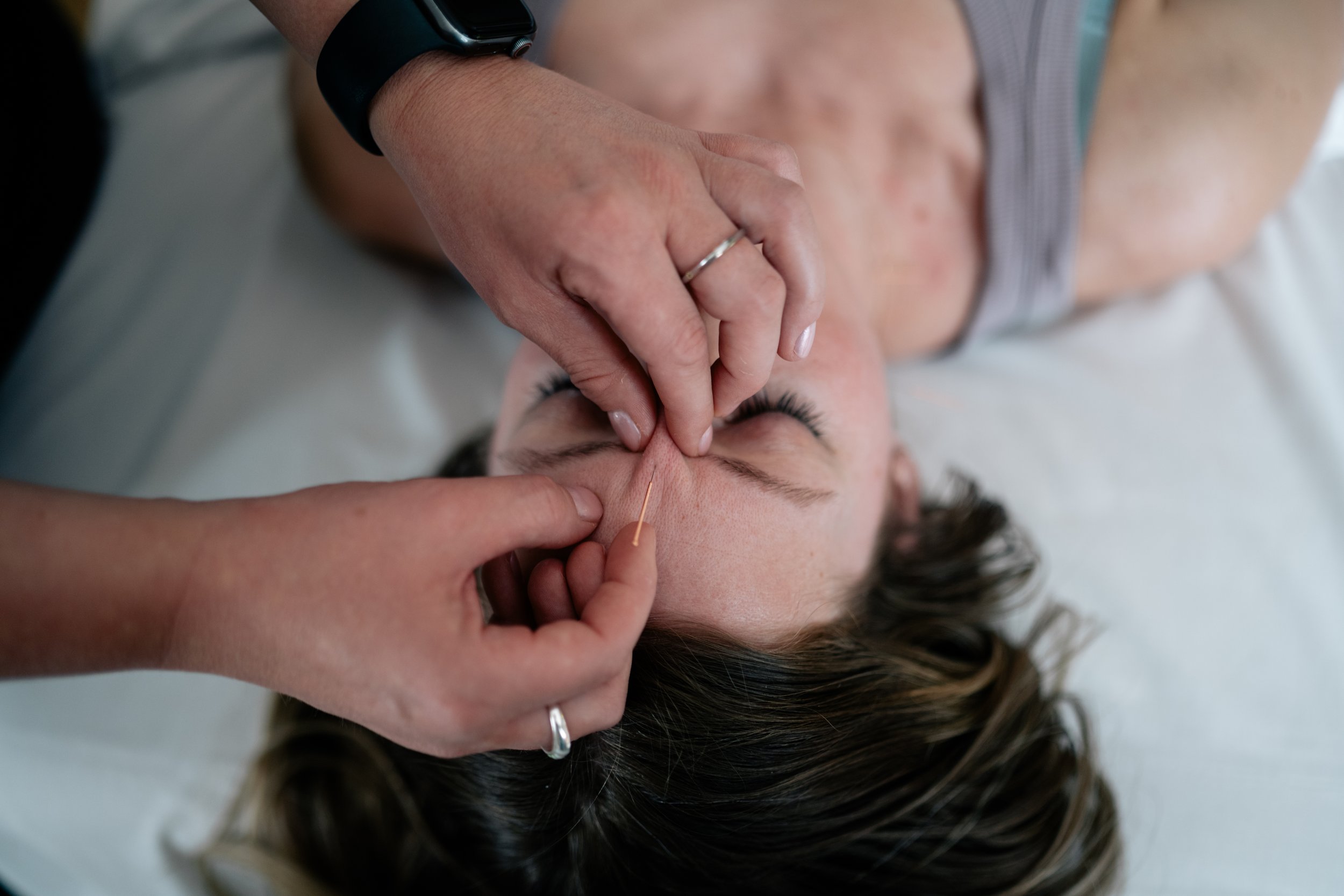 Acupuncture &amp; Nervous System Regulation: How Acupuncture Can Help Your Body Find Balance