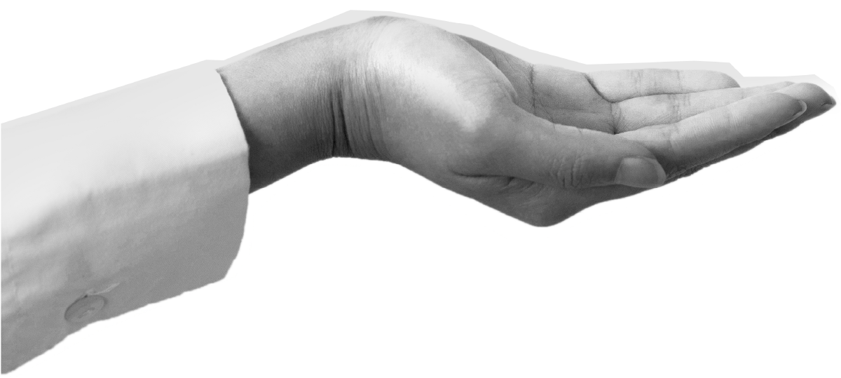 A grayscale image of an open human hand with palm facing upward, against a plain background.