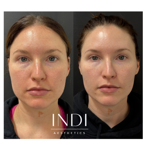 Medspa in Sidney, MT, 59270 | Botox Near Me