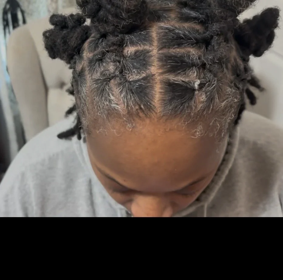 Top view of a person's head with short curly hair in the process of being styled or treated, with some patches of unprocessed hair and a visible part line.