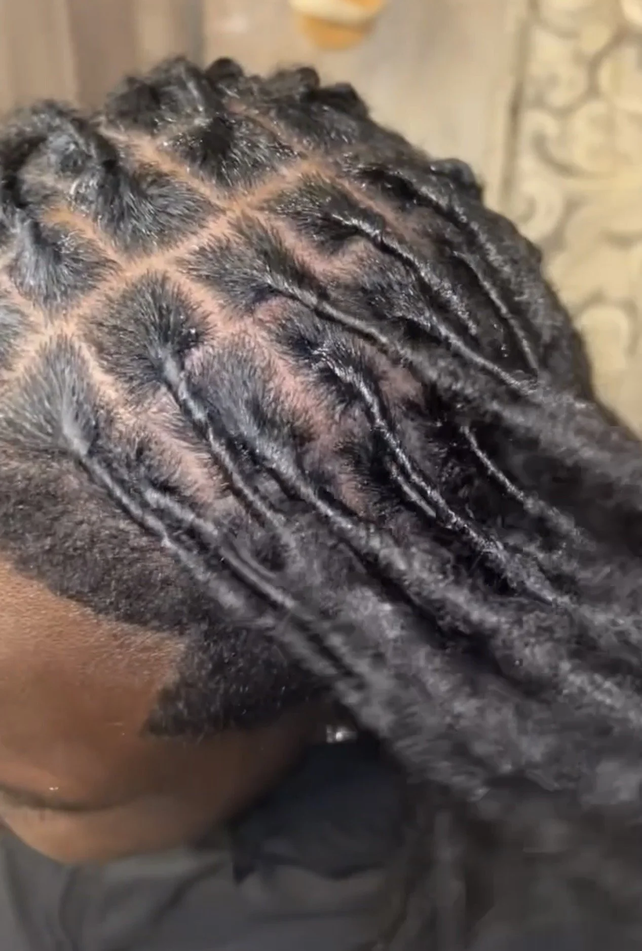 Close-up of a person's scalp with freshly braided hair.