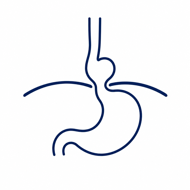 Minimalist illustration of a stomach and esophagus showing a hiatus hernia.