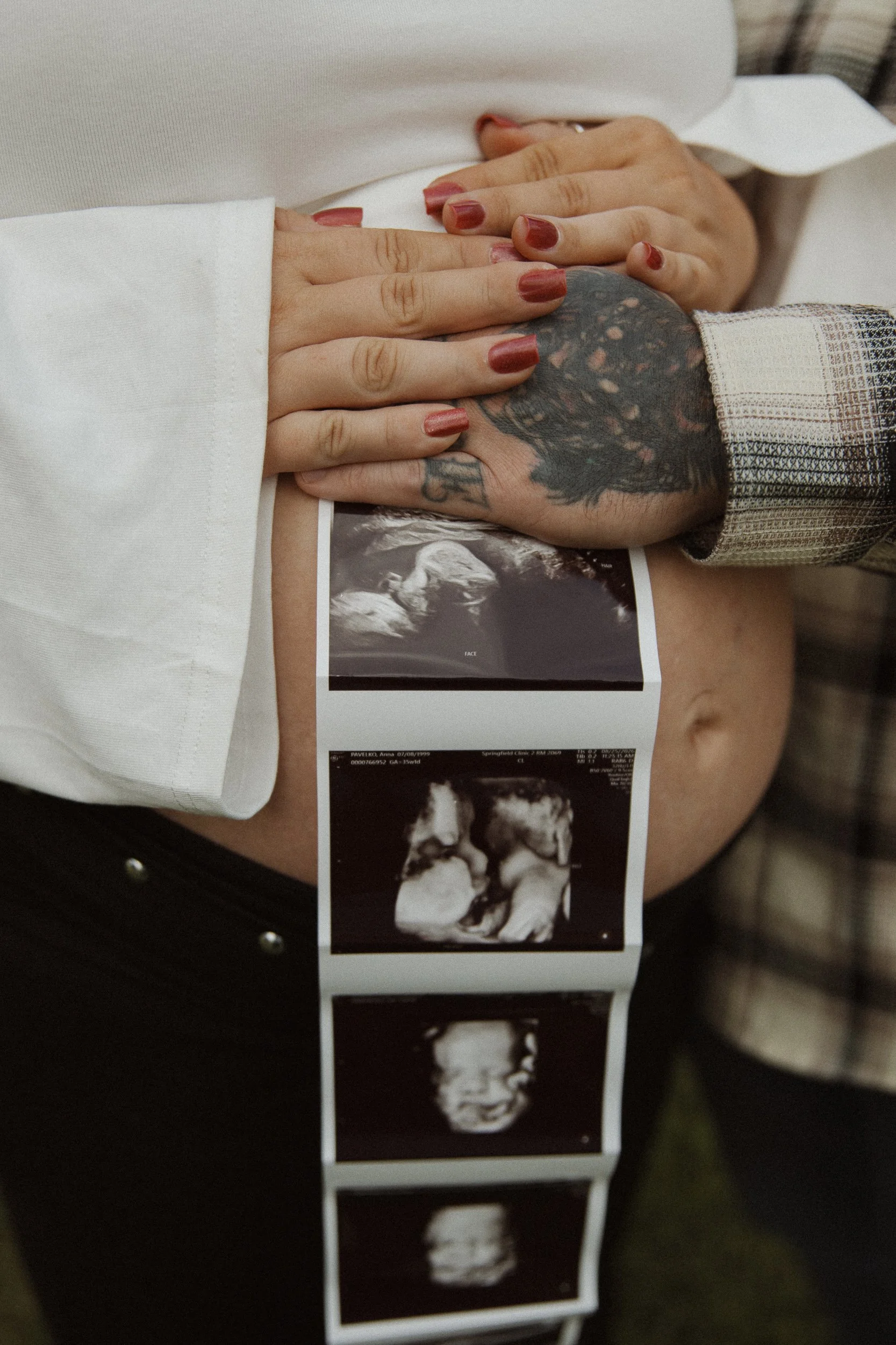 anna-and-aaron-maternity-web-22.jpg