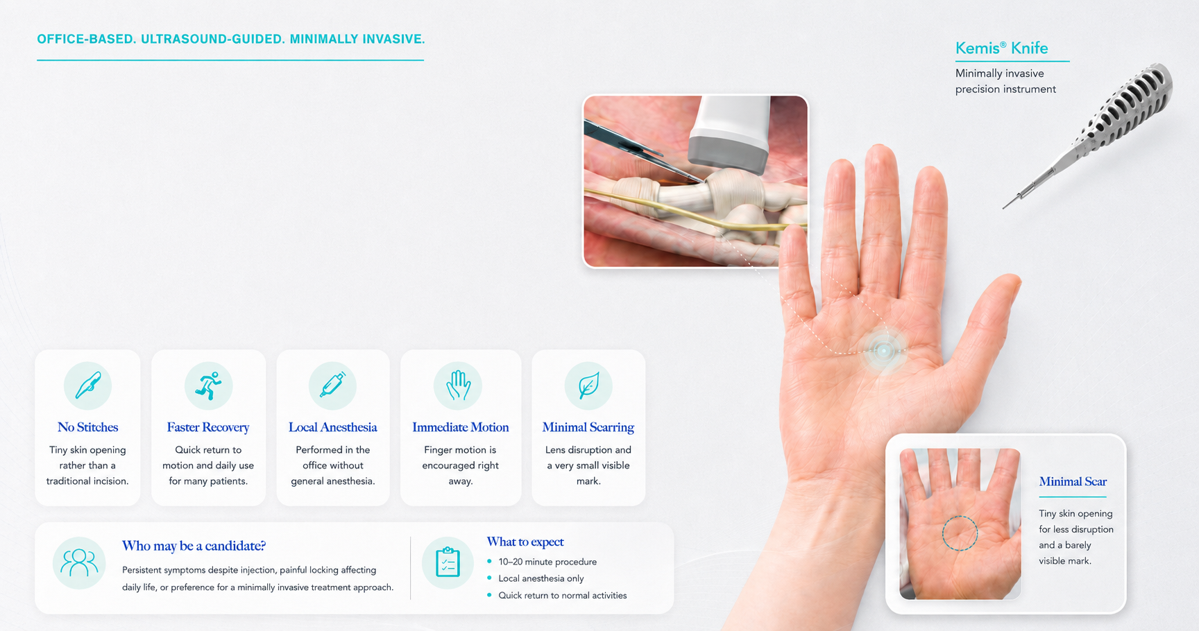 An informational graphic about office-based, ultrasound-guided minimally invasive procedures for hand treatment. It includes images of a hand with a marked minimal scar, a close-up of a medical procedure with ultrasound guidance, and a precision instrument called Kemis Knife. The graphic highlights features such as no stitches, faster recovery, local anesthesia, immediate motion, and minimal scarring.