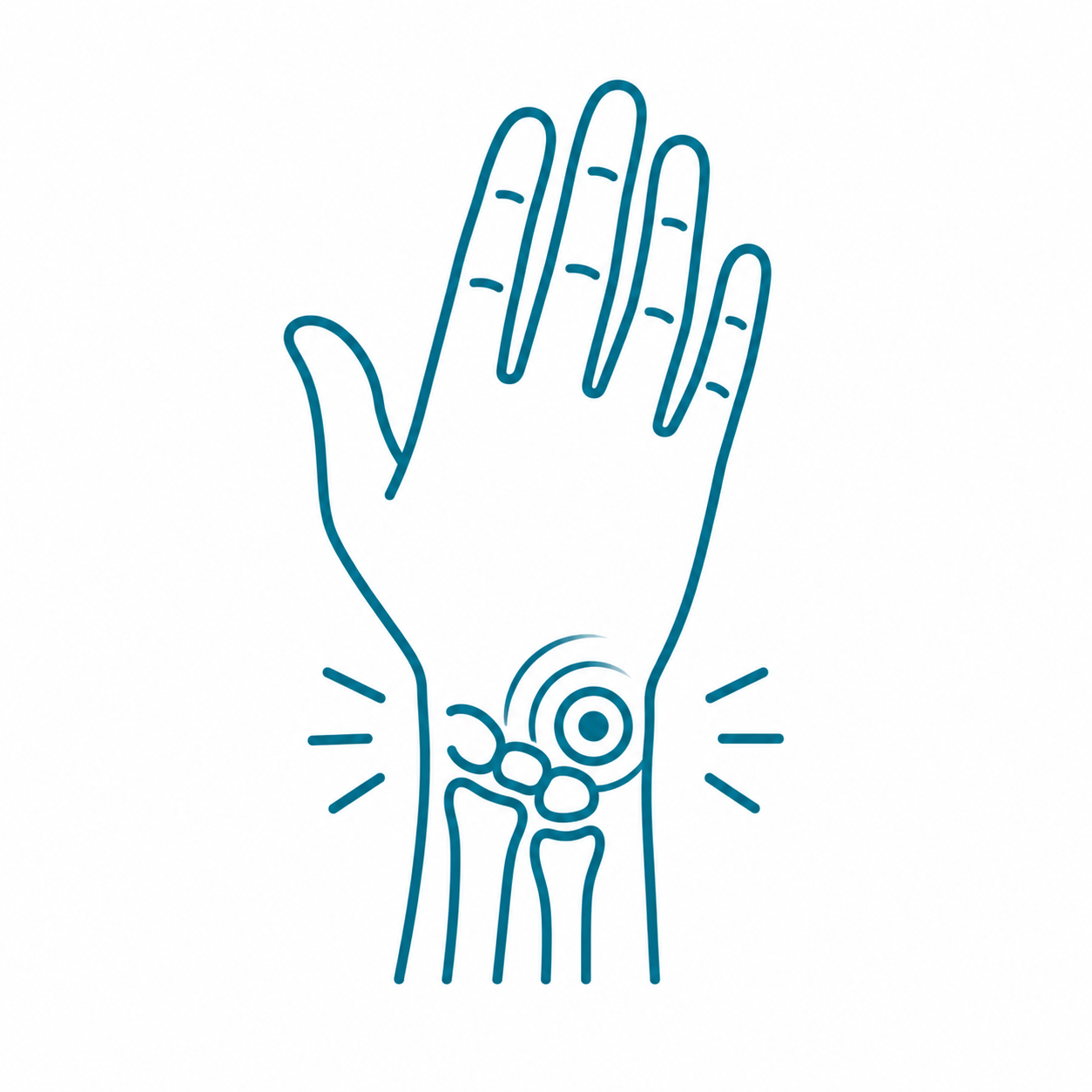 Minimalist line drawing of a human hand with a wristwatch, displaying wrist bones and alert lines around the wrist.