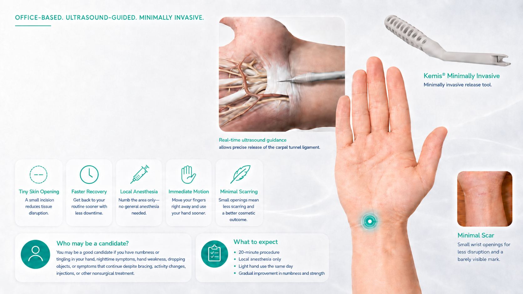 Medical infographic illustrating office-based, ultrasound-guided, minimally invasive carpal tunnel release procedure. Shows a hand with a small scar and a real-time ultrasound guide targeting the carpal tunnel ligament, with icons and text highlighting procedure benefits and candidate information.