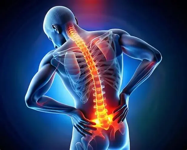 Low Back Pain