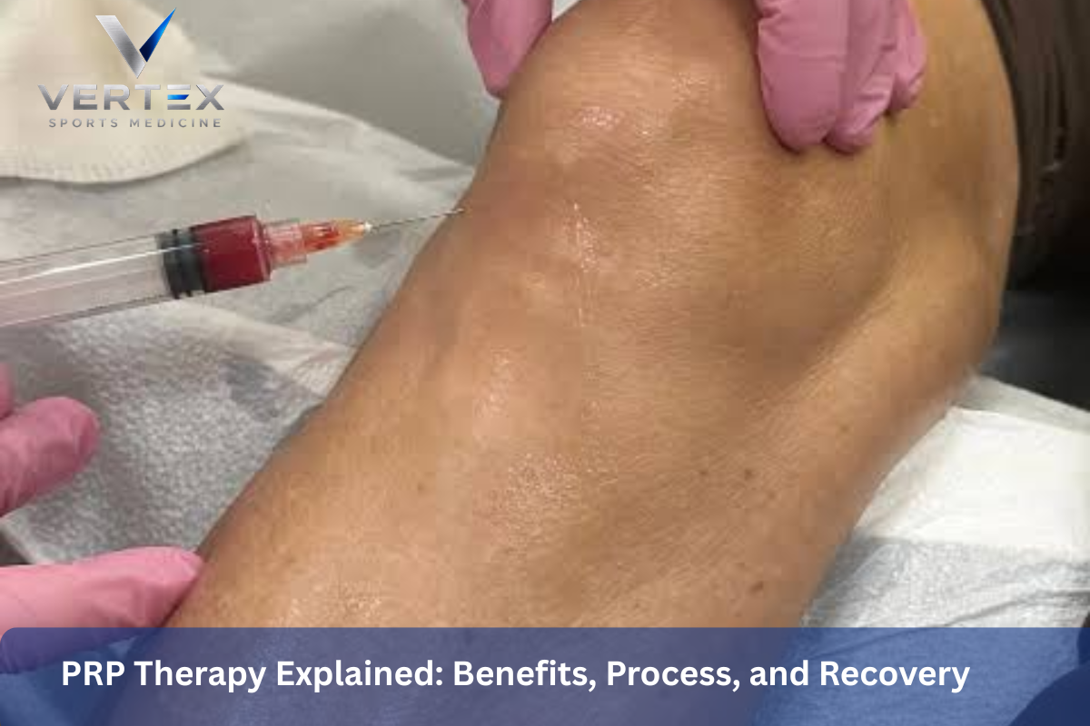 PRP Therapy Explained: Benefits, Process, and Recovery