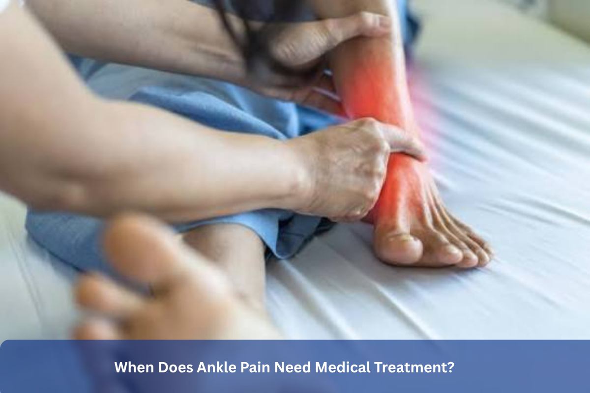 When Does Ankle Pain Need Medical Treatment?