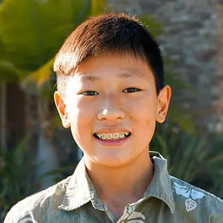 Invisalign in Duncanville, TX
