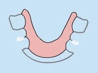 Retainers in Duncanville, TX