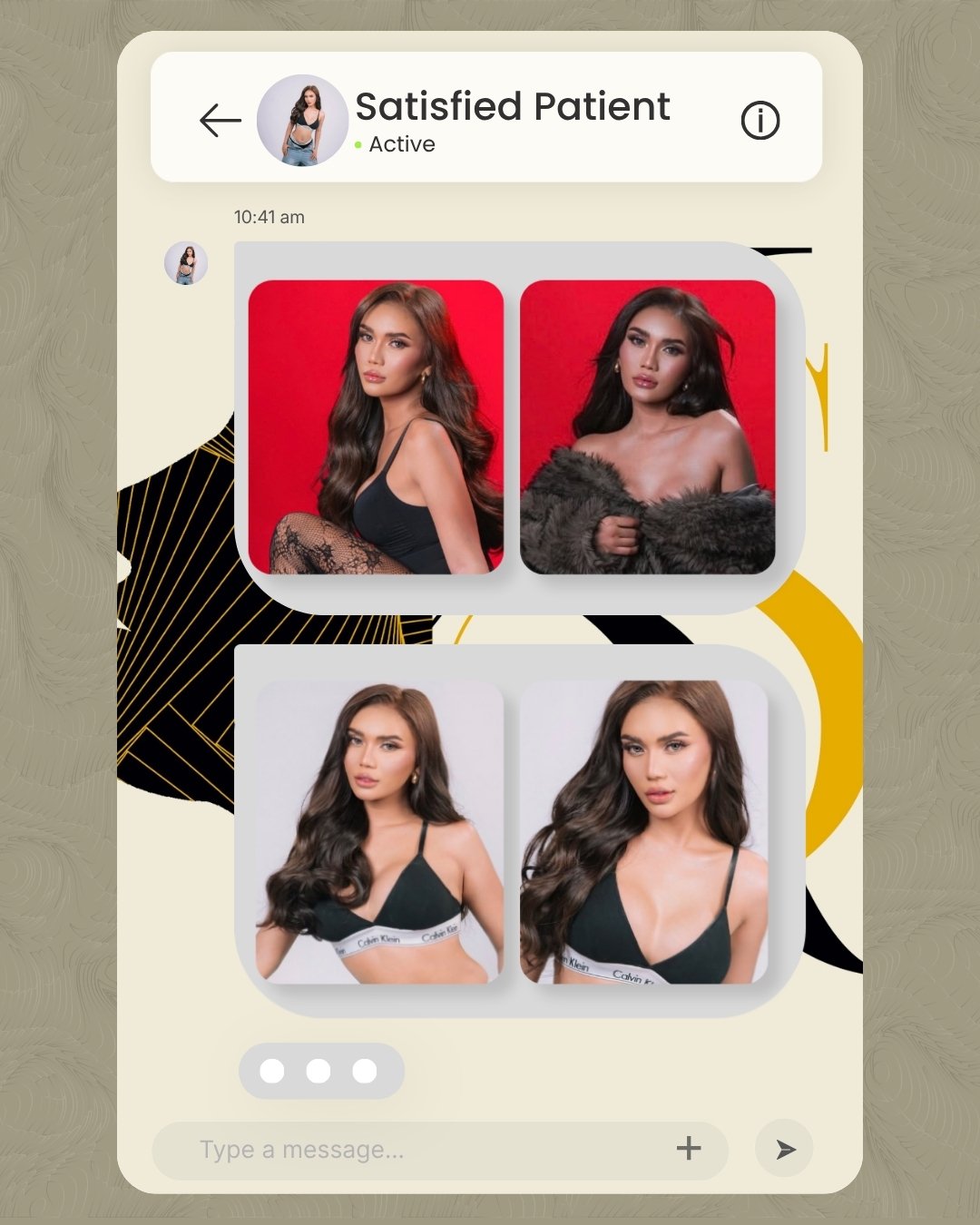 &ldquo;Super ganda talaga ng healing process ko, Doc.&rdquo;

This patient underwent breast augmentation with 375cc high-profile implants, selected as part of her personalized surgical plan.

We&rsquo;re grateful for the trust she placed in us throug