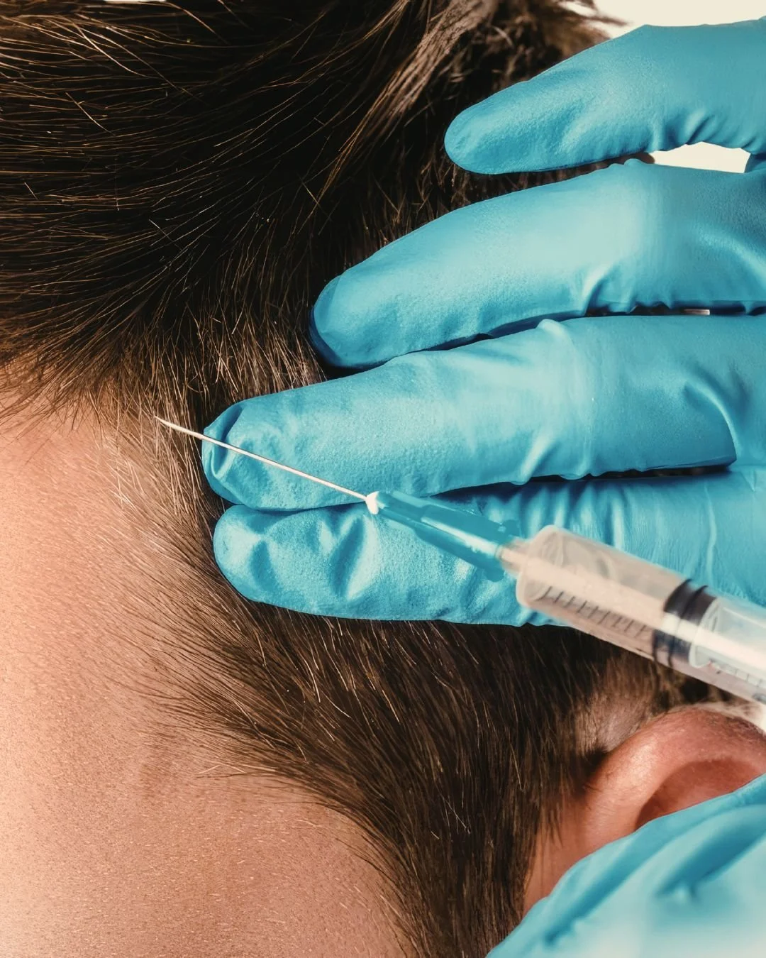 Hair Restoration