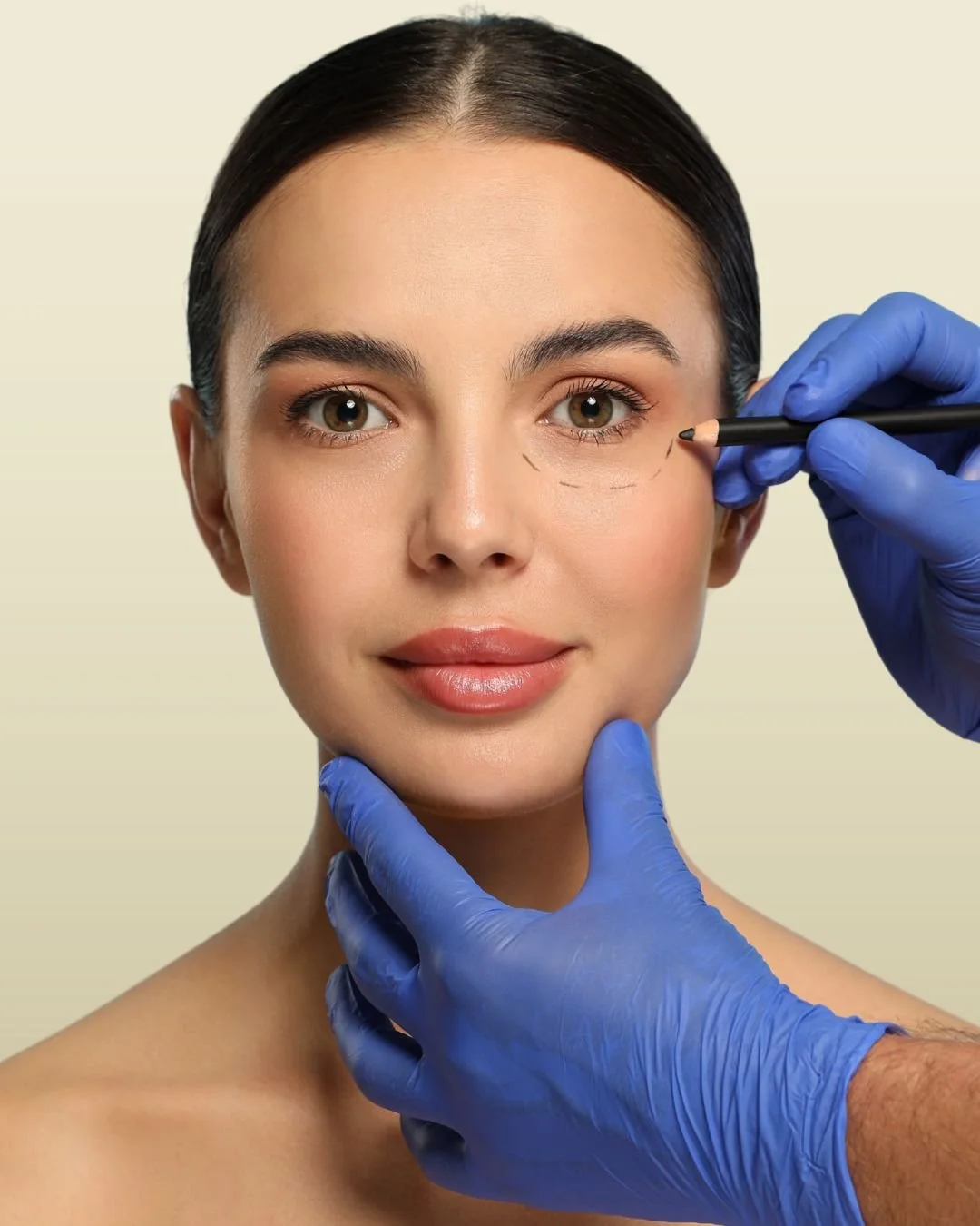 Lower Blepharoplasty