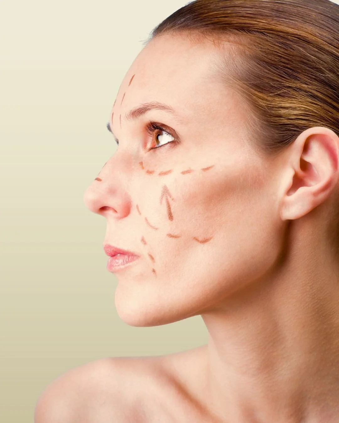 Facial Fat Grafting