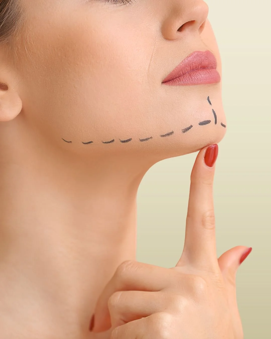 V Line Liposuction/Double Chin Liposuction