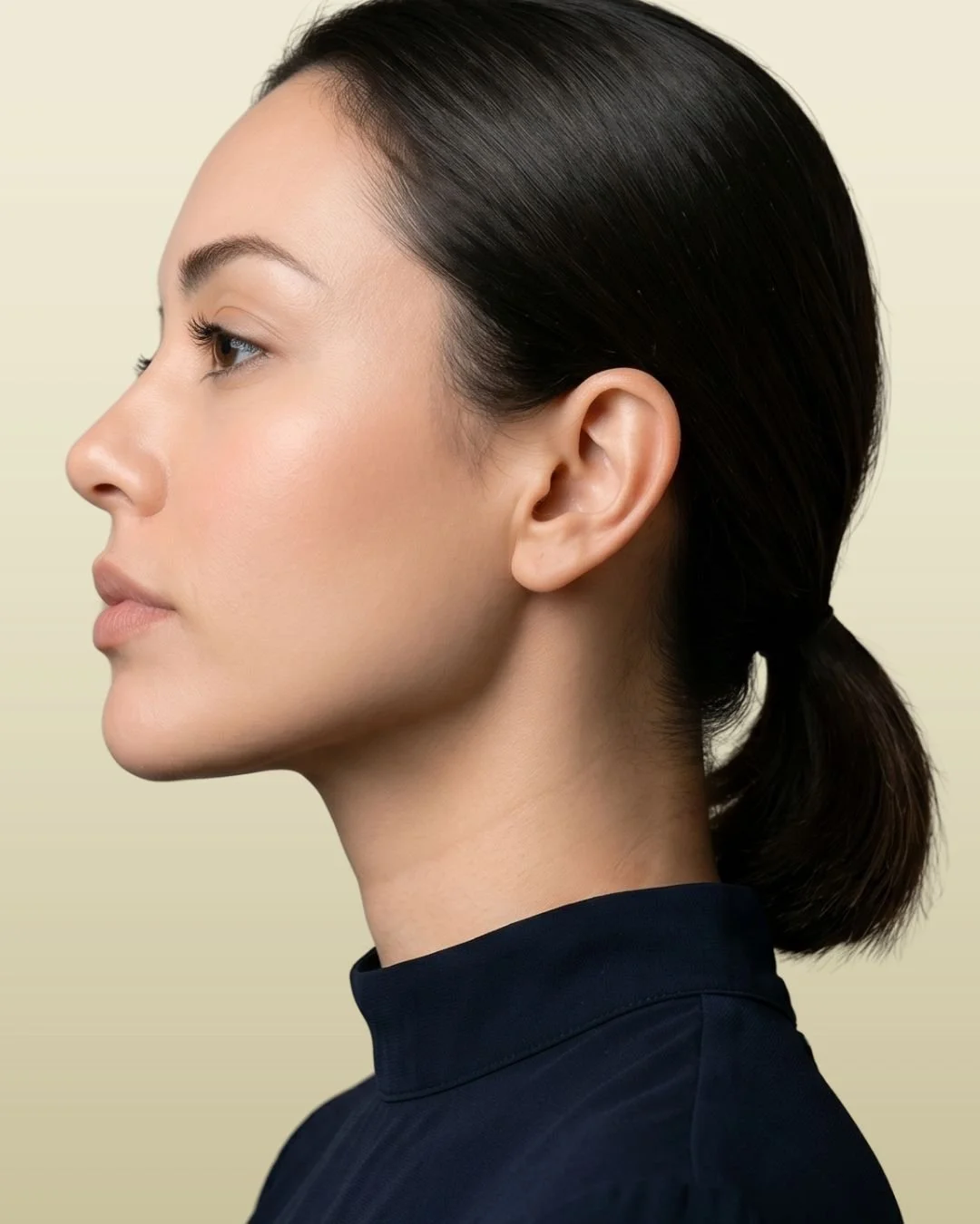 Chin Augmentation