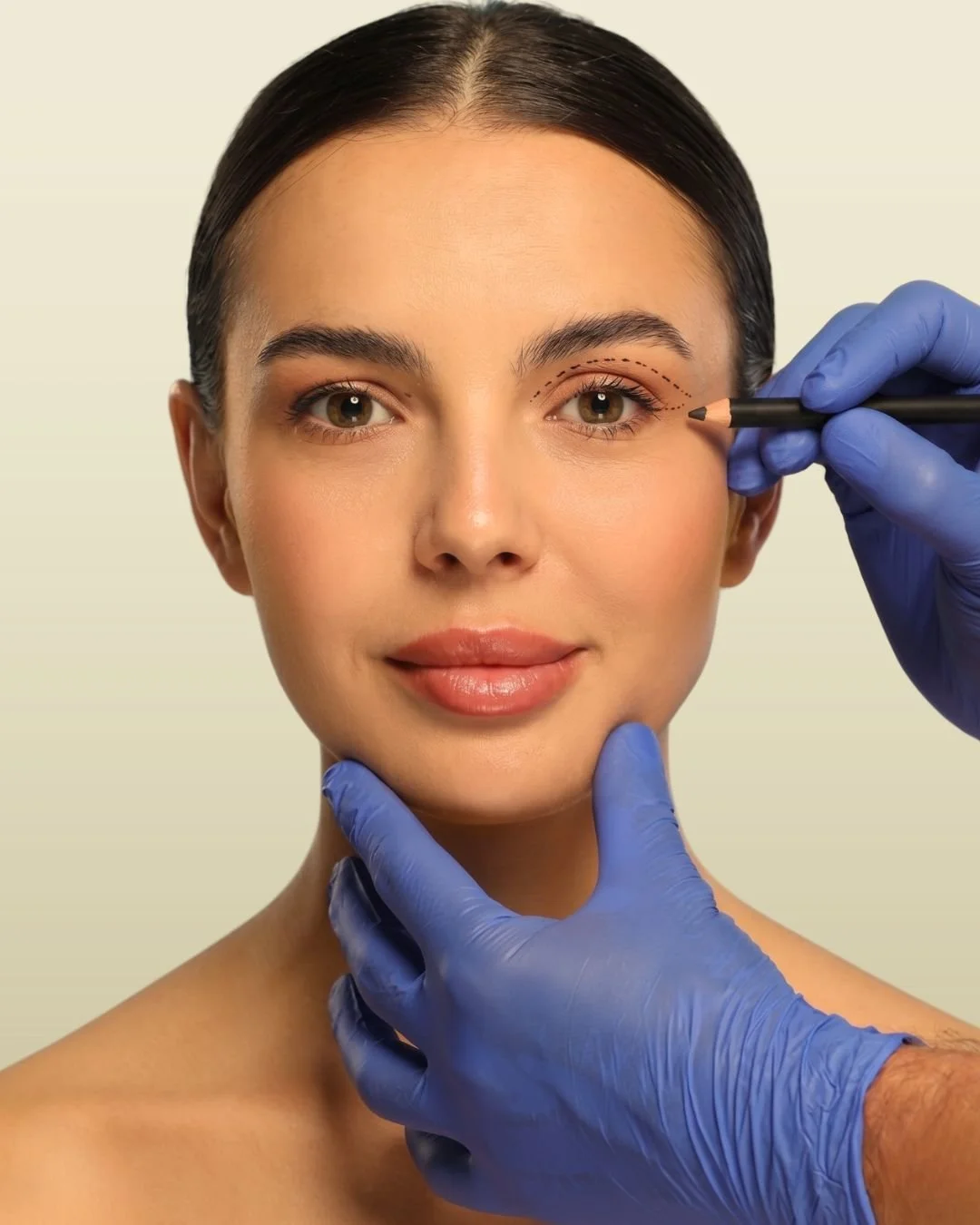 Upper Blepharoplasty