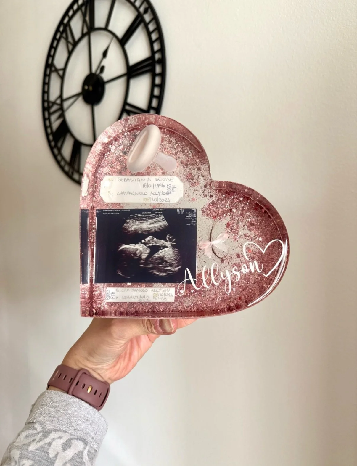 Una creazione di resina con un'ecografia di una gravidanza e il nome "Allyson" scritto con un cuore, su uno sfondo rosa glitterato.