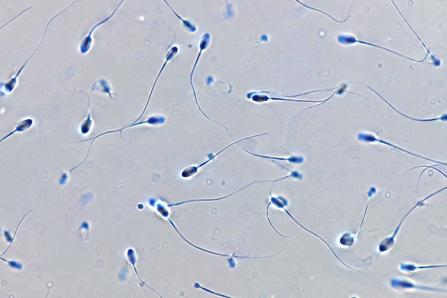 Supporting Healthy Sperm: A Practical Guide for Preconception