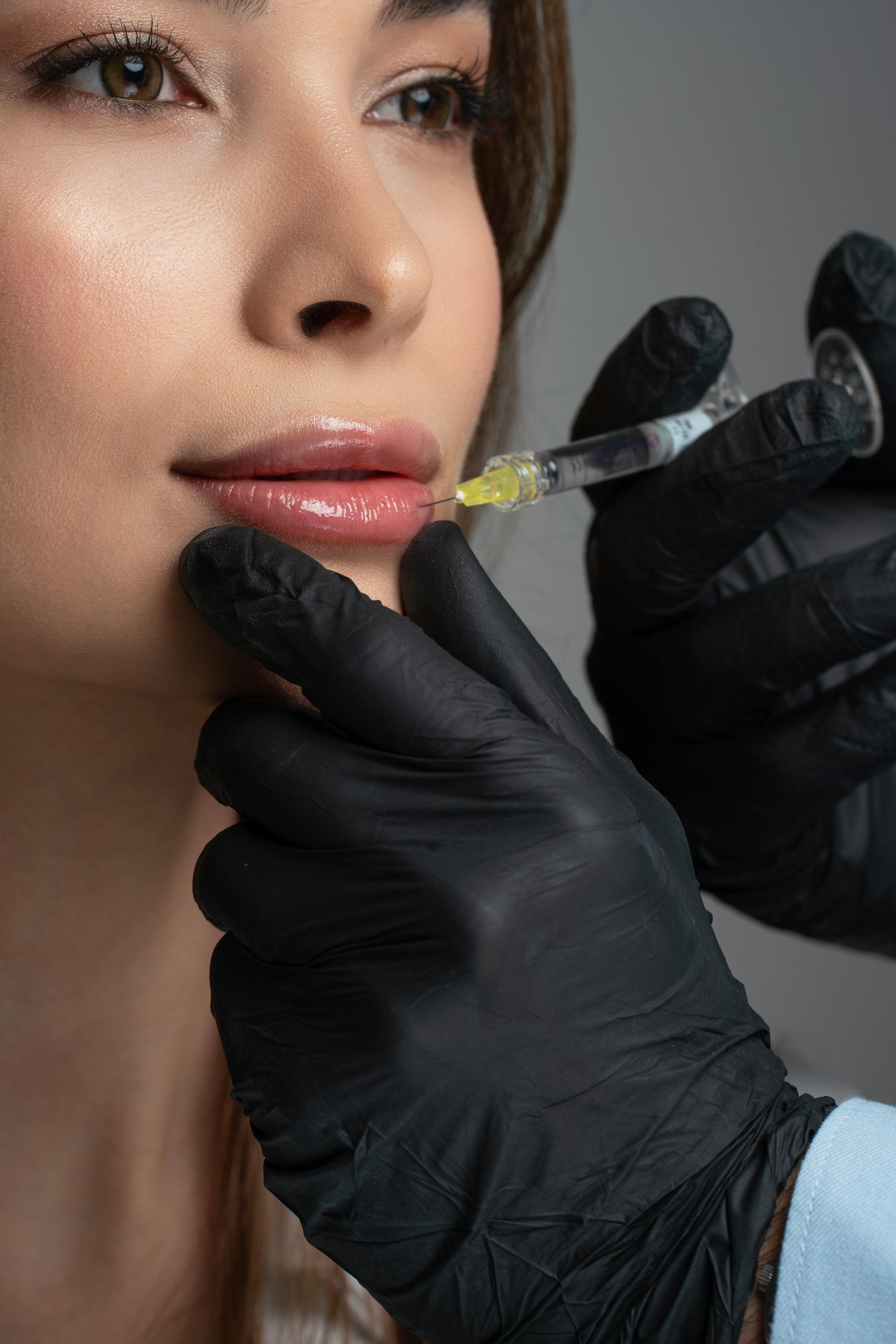 Medspa in Edina, MN 55424 l Fillers Near Me
