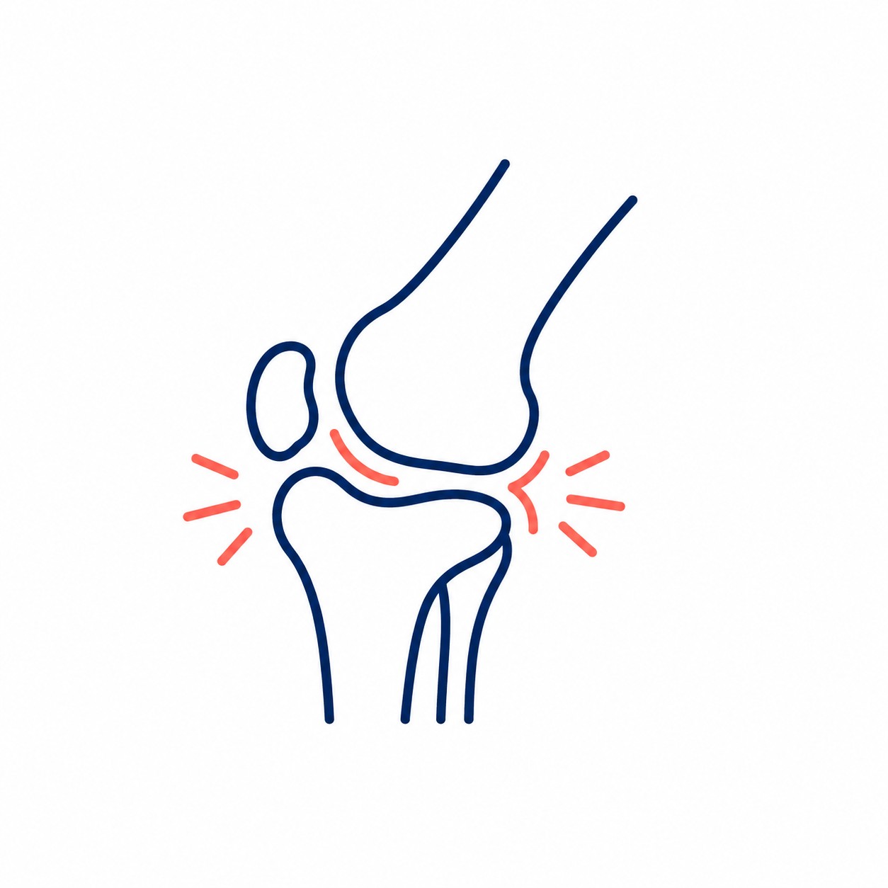 Line drawing of a knee joint showing pain points with red marks and highlighted areas.
