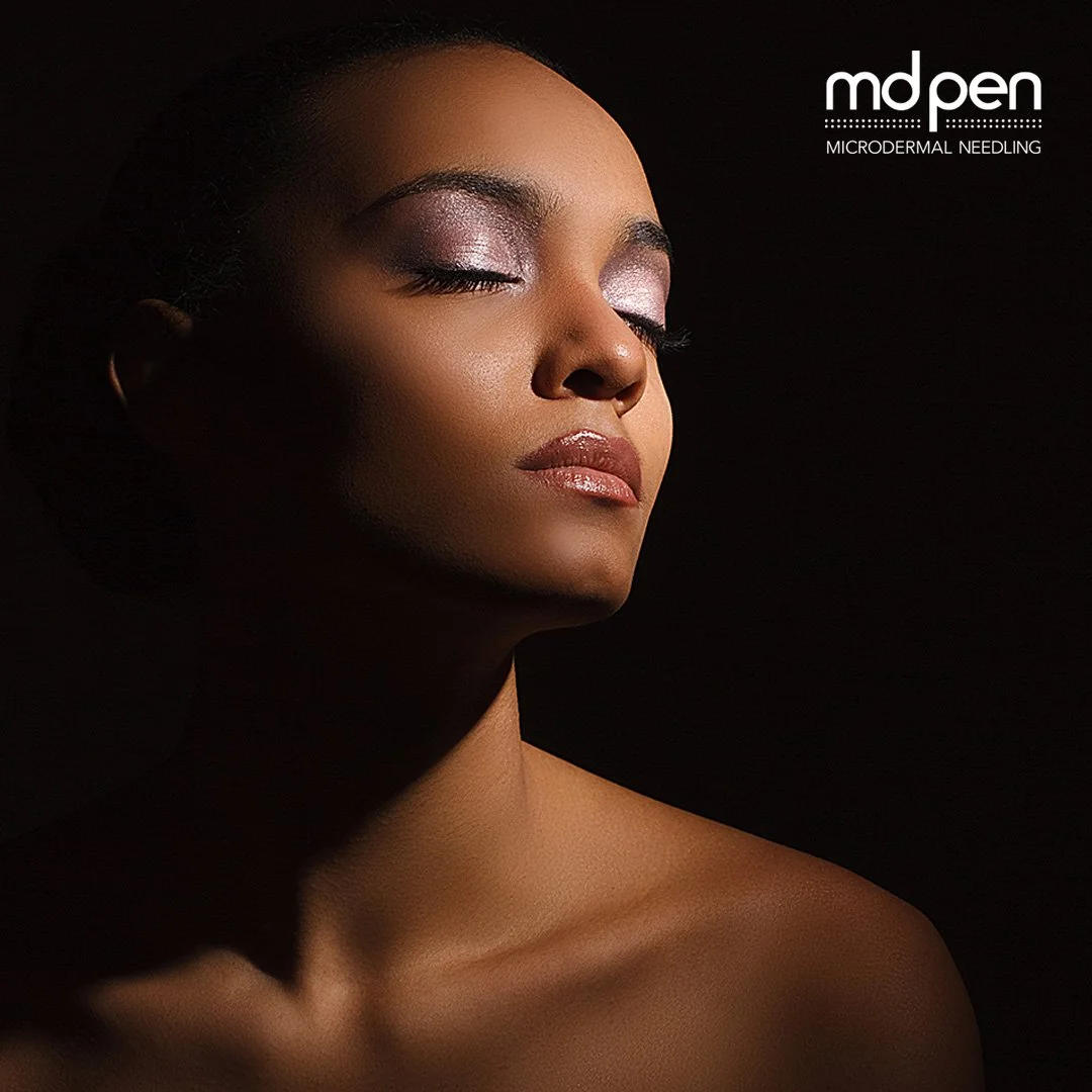 Close-up of a woman with closed eyes, wearing light pink eyeshadow and glossy lips, against a dark background, with text in the upper right corner related to microdermal needling.