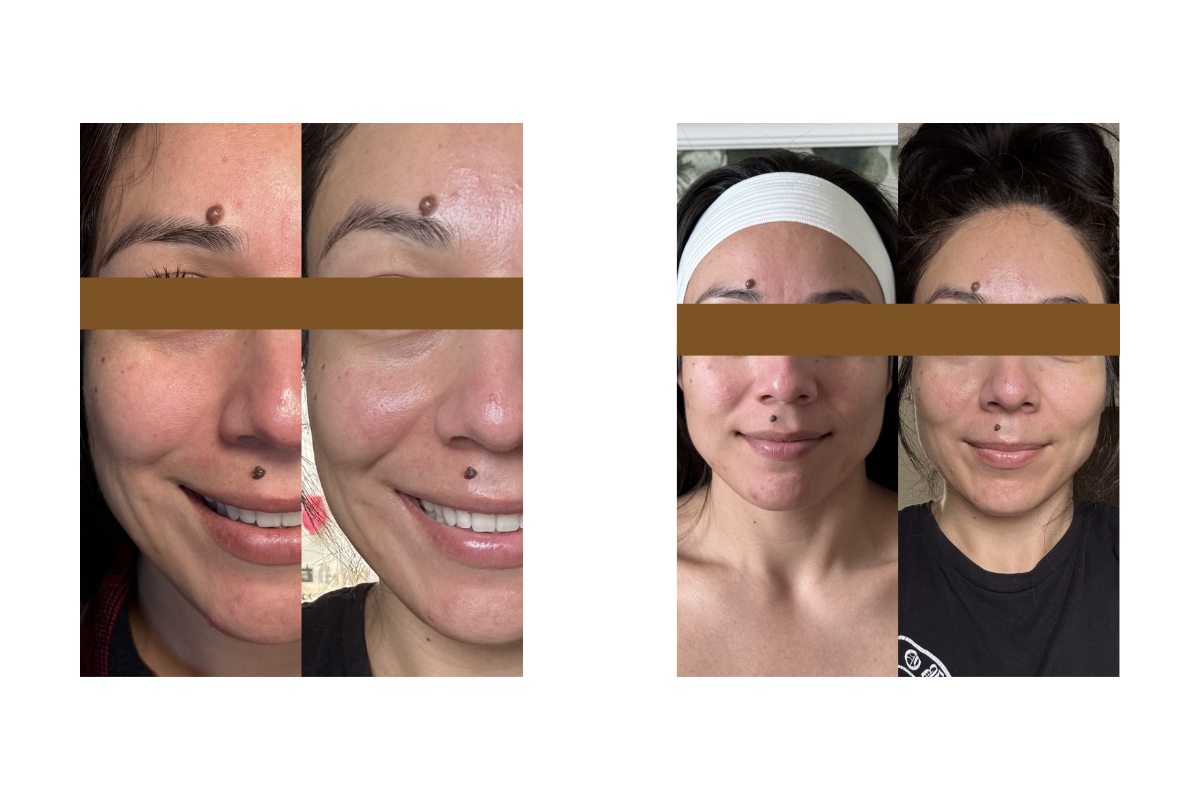 Comparison of skincare before and after results showing close-up images of women's faces with and without makeup or skincare treatment, highlighting skin improvements.
