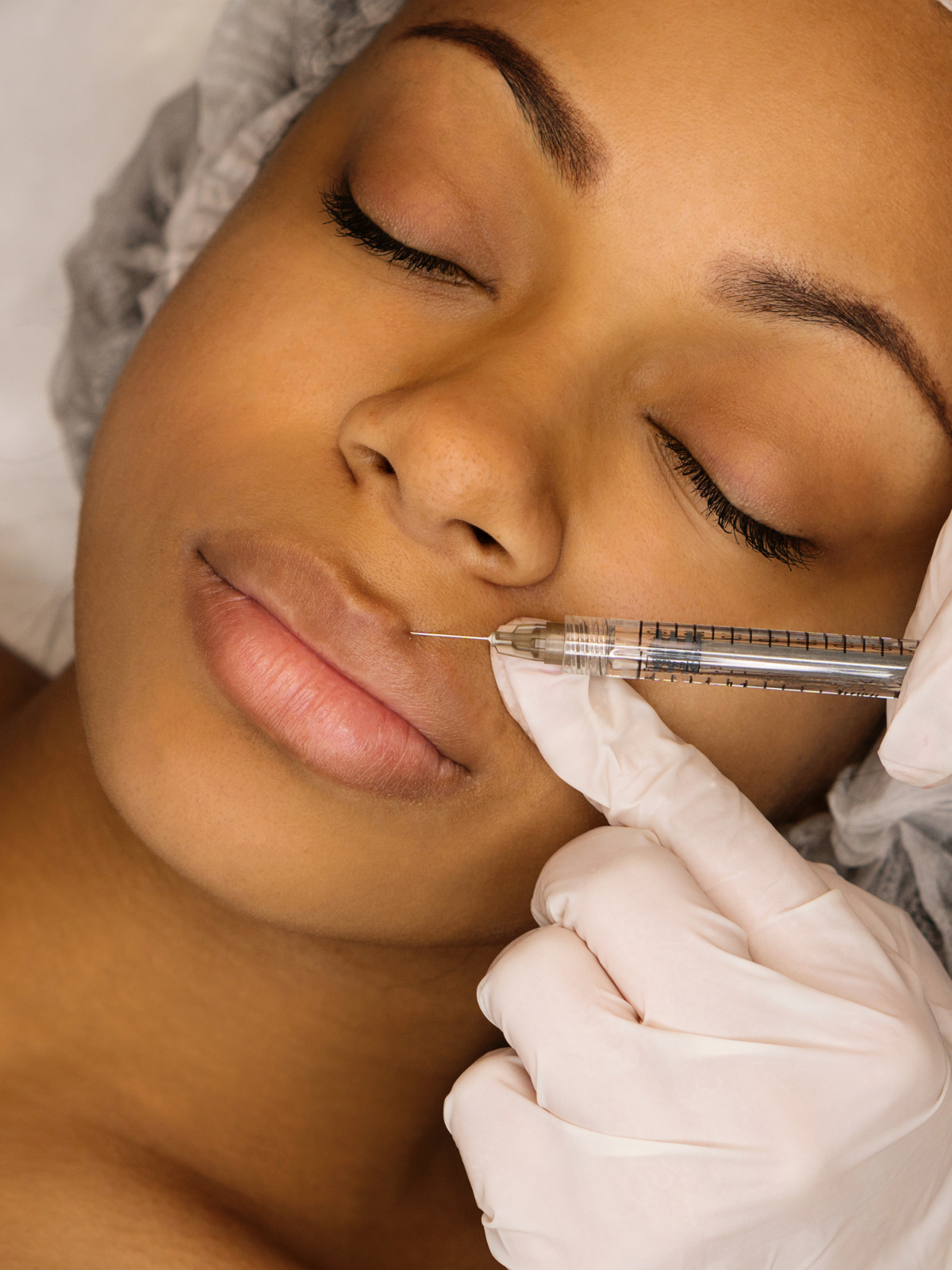 A woman receiving a cosmetic injection near her lips from a healthcare professional wearing gloves.