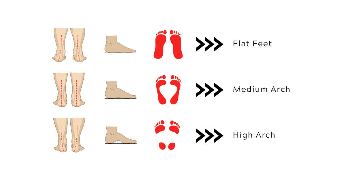 How to Choose the Right Shoes for Your Foot Type