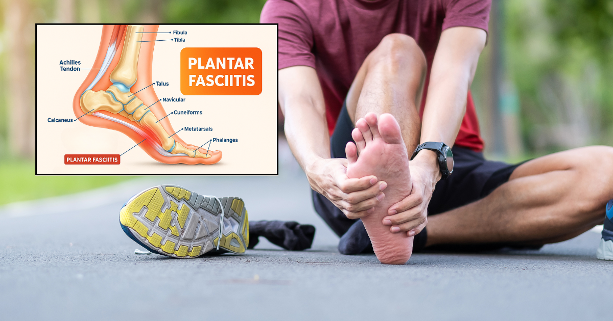 The Worst Shoes for Plantar Fasciitis