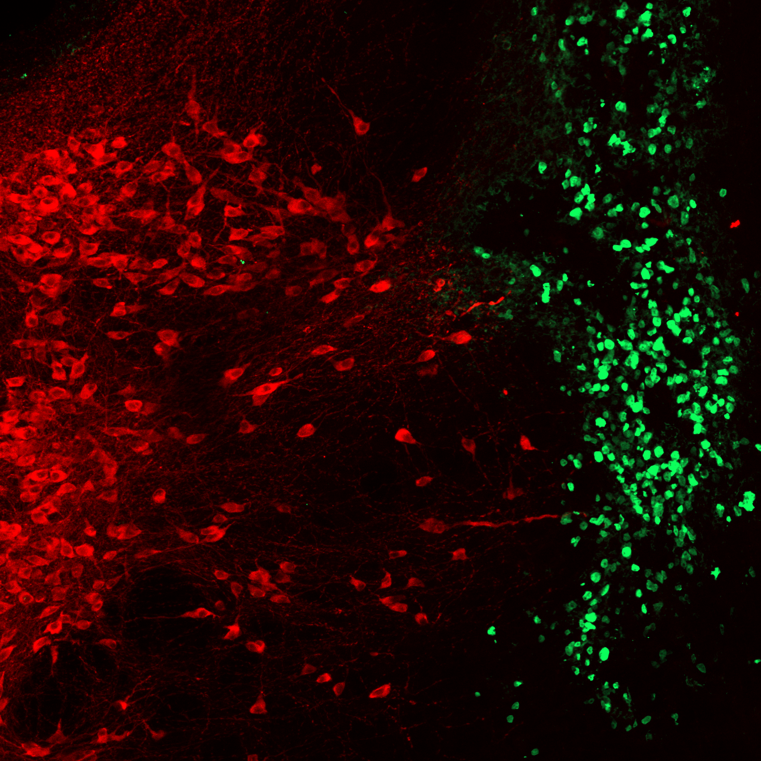 Microscopic image of serotonergic neurons, highlighted in red, and infiltrating cancer cells in green coloring.